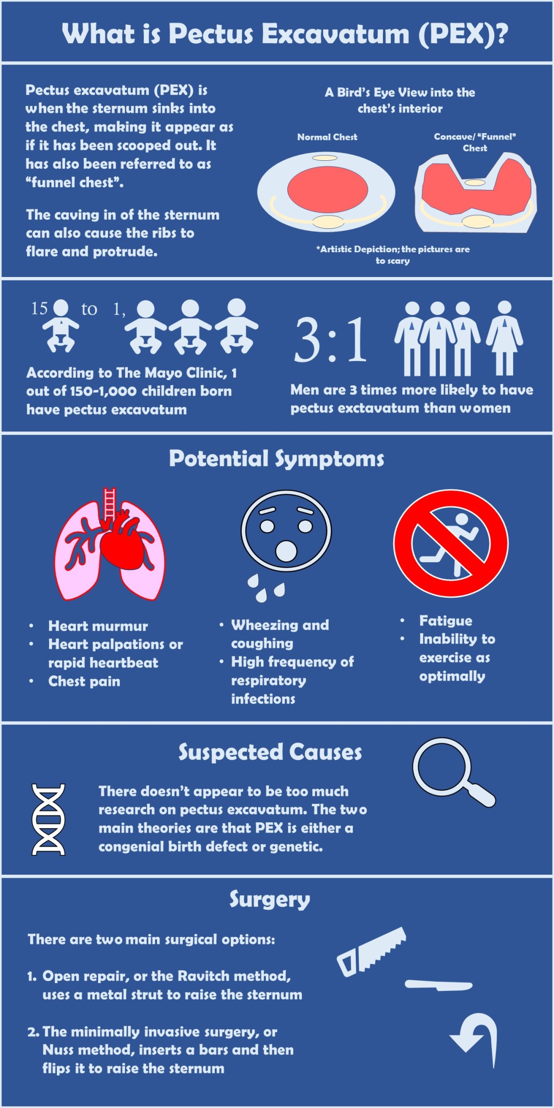 Pectus Excavatum Infographic